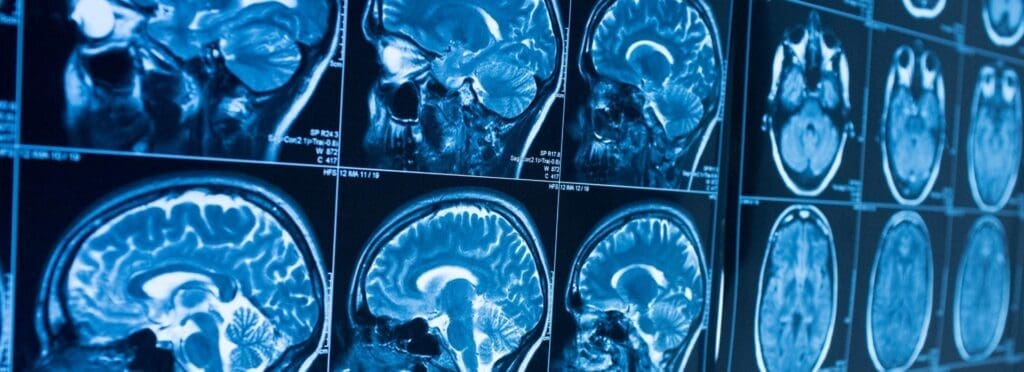10 Radiology Tips For Faster Diagnosis