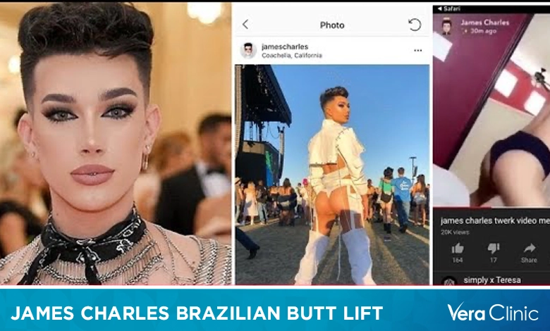 12 James Charles Brazilian Butt Lift Tips