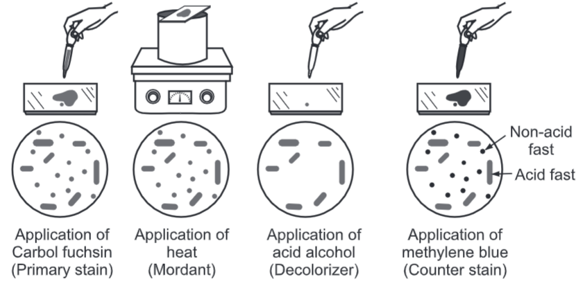 Acid Fast Staining Procedure