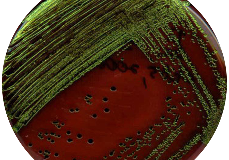 Emb In Microbiology