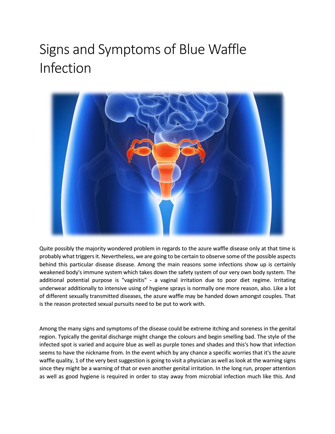 How To Cure Blue Waffle? Symptoms And Solutions