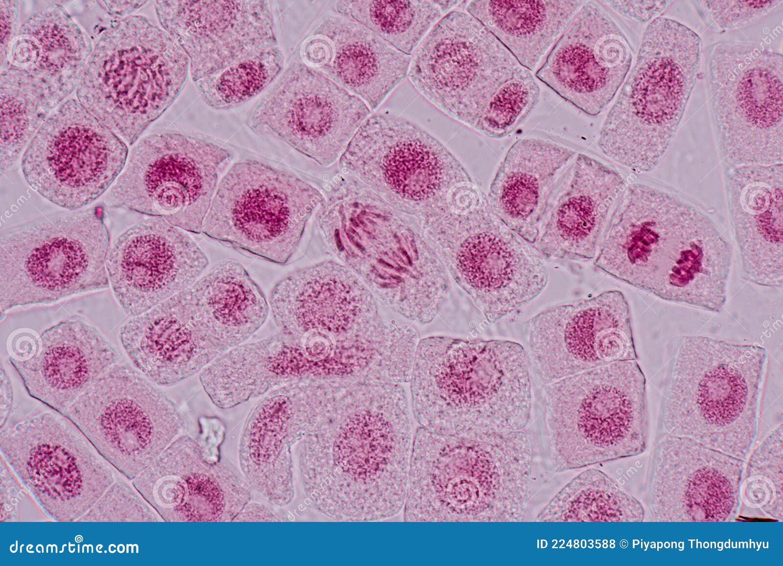 Prometaphase Onion Root Tip