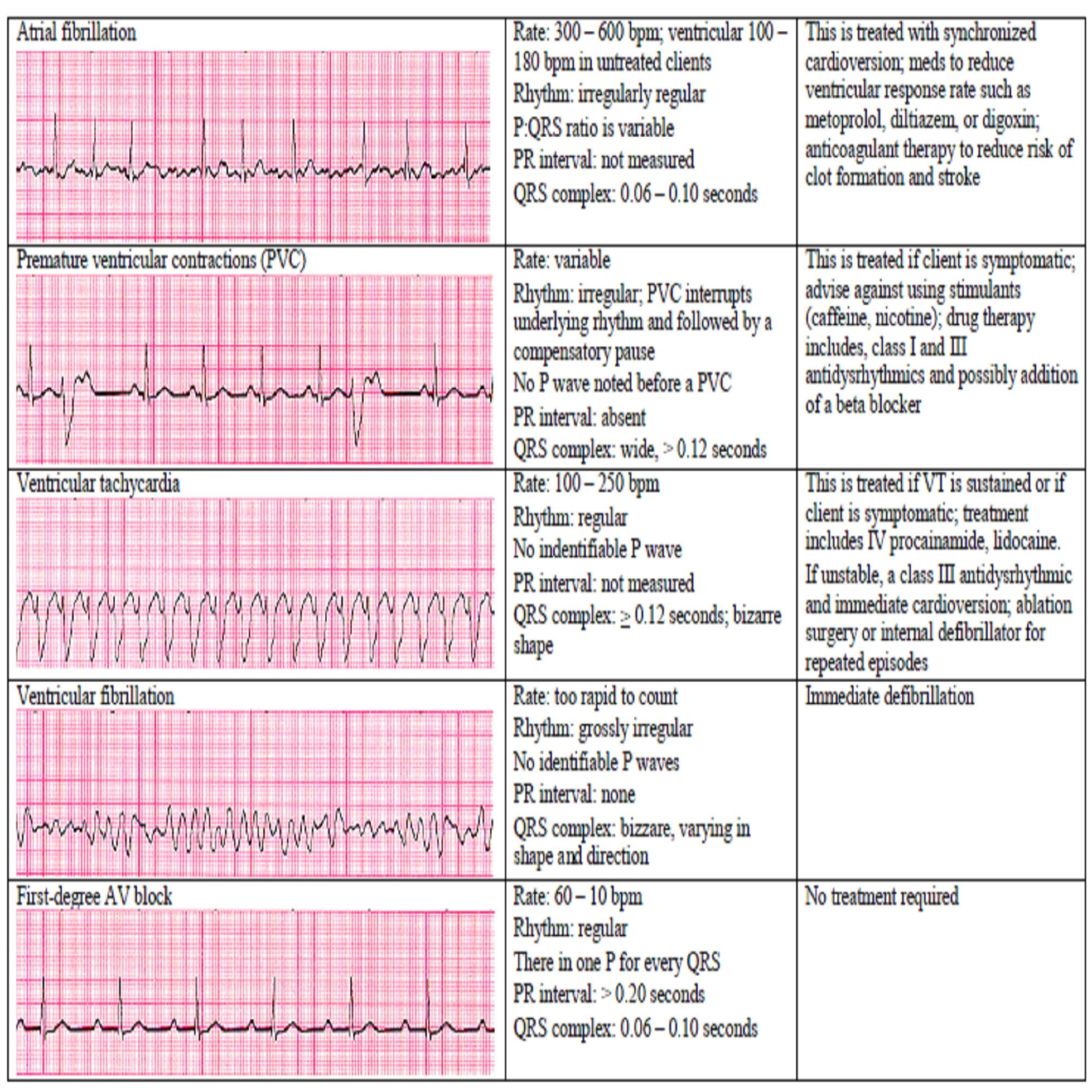What Is Cardiac Nurse Role? Expert Career Guide